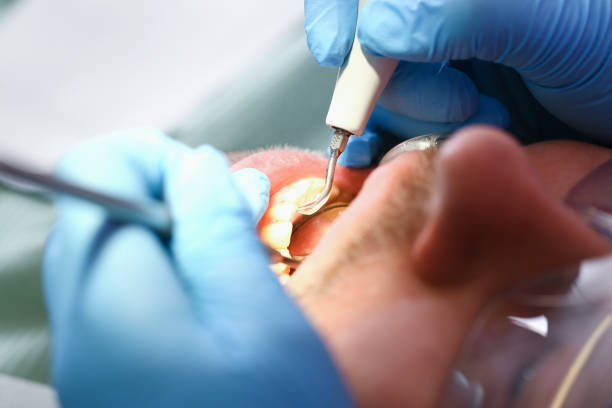 Best Emergency Broken Tooth Repair in Tanaina, AK